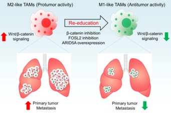 Mechanism demonstrating how tumour-impeding macrophages transform into tumour-stimulating macrophages. Mechanism demonstrating how tumour-impeding macrophages transform into tumour-stimulating macrophages.