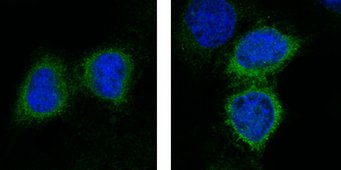 Formation of PDE4 in oxygen-deficient lung tumour cells. Lung cells produce PDE4 (stained green: left) even if their oxygen content is normal. More PDE4 is produced (right) if they are oxygen-deficient (hypoxia). The cell nuclei are stained blue. Formation of PDE4 in oxygen-deficient lung tumour cells. Lung cells produce PDE4 (stained green: left) even if their oxygen content is normal. More PDE4 is produced (right) if they are oxygen-deficient (hypoxia). The cell nuclei are stained blue.