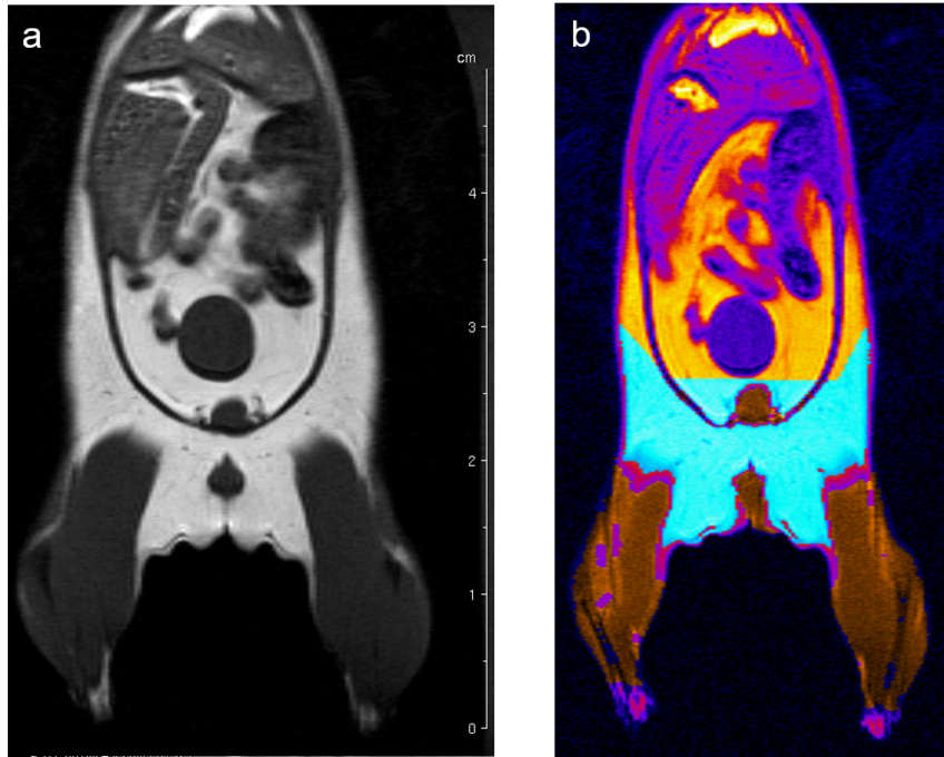 Fig. 6: Determination of body fat in mouse. (a) A MSME sequence with a repetition time of 452 ms, echo time of 8.6 ms, field of view 7.0x7.0 cm2 covering the entire body and lower legs, a matrix of 512x256 and slice thickness of 1.0 mm was used to acquire 20 coronal slices with1.0 mm slice thickness and 1.0 mm interslice distance. (b) After evaluation the region in cyan represents the quantified fat and the region in brown the quantified muscle volume. Fig. 6: Determination of body fat in mouse. (a) A MSME sequence with a repetition time of 452 ms, echo time of 8.6 ms, field of view 7.0x7.0 cm2 covering the entire body and lower legs, a matrix of 512x256 and slice thickness of 1.0 mm was used to acquire 20 coronal slices with1.0 mm slice thickness and 1.0 mm interslice distance. (b) After evaluation the region in cyan represents the quantified fat and the region in brown the quantified muscle volume.