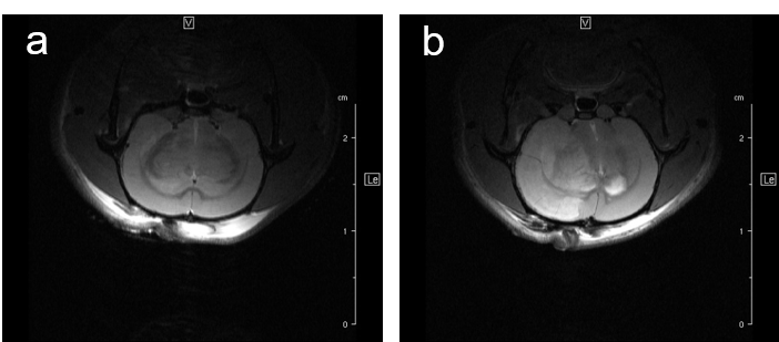 Fig. 7: Infarcted rat brain MRI. For comparison of infarct size of induced infarct right after OP and 24 h later a T2 weighted Spinecho sequence was used: repetition time: 3800 ms, echo time: 18.0 ms, field of view: 35x35 mm2, matrix:512x256 and slice thickness 1.0 mm was used to acquire 12 axial slices. Fig. 7: Infarcted rat brain MRI. For comparison of infarct size of induced infarct right after OP and 24 h later a T2 weighted Spinecho sequence was used: repetition time: 3800 ms, echo time: 18.0 ms, field of view: 35x35 mm2, matrix:512x256 and slice thickness 1.0 mm was used to acquire 12 axial slices.