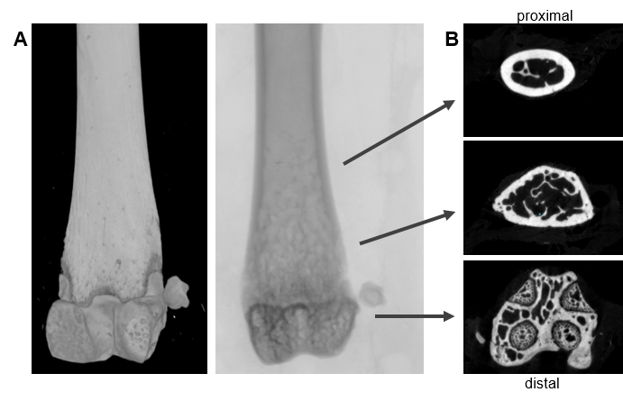 Fig. 8: Microcomputer tomography (µCT) of mouse distal femur. (A) longitudinal view of distal femur (B) transaxial view from distal to proximal; bottom: transaxial view of the epiphyseal reagion of the femur; middle: trabecular bone, transaxial view of the metaphyseal region; top: transaxial view of diaphyseal region. Scan options: X-ray voltage: 70 KV, X-ray current: 200 µA, filter: Al 0.5 mm, image pixel size: 4 µm, tomographic rotation: 180°, rotation step: 0.200°, frame averaging: 8, scan duration: 1h15min. Pictures provided by Sabrina Sapski, Department II. Fig. 8: Microcomputer tomography (µCT) of mouse distal femur. (A) longitudinal view of distal femur (B) transaxial view from distal to proximal; bottom: transaxial view of the epiphyseal reagion of the femur; middle: trabecular bone, transaxial view of the metaphyseal region; top: transaxial view of diaphyseal region. Scan options: X-ray voltage: 70 KV, X-ray current: 200 µA, filter: Al 0.5 mm, image pixel size: 4 µm, tomographic rotation: 180°, rotation step: 0.200°, frame averaging: 8, scan duration: 1h15min. Pictures provided by Sabrina Sapski, Department II.