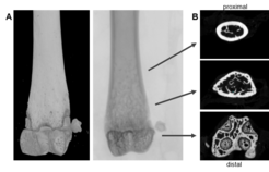 Fig. 8: Microcomputer tomography (µCT) of mouse distal femur. (A) longitudinal view of distal femur (B) transaxial view from distal to proximal; bottom: transaxial view of the epiphyseal reagion of the femur; middle: trabecular bone, transaxial view of the metaphyseal region; top: transaxial view of diaphyseal region. Scan options: X-ray voltage: 70 KV, X-ray current: 200 µA, filter: Al 0.5 mm, image pixel size: 4 µm, tomographic rotation: 180°, rotation step: 0.200°, frame averaging: 8, scan duration: 1h15min. Pictures provided by Sabrina Sapski, Department II.