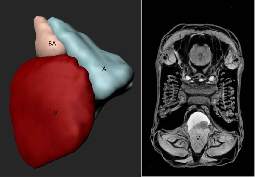 Fig. 11: Microcomputer tomography (µCT) of ex-vivo zebrafish heart. (a) fixed ……..X-ray voltage: 55 KV, X-ray current: 72 µA, filter: Al 0.25 mm, image pixel size: 2.9 µm, tomographic rotation: 180°, rotation step: 0.250°, frame averaging: 4, scan duration: 1h11min. Pictures provided by Anabela Bensimon-Brito, Department III. Fig. 11: Microcomputer tomography (µCT) of ex-vivo zebrafish heart. (a) fixed ……..X-ray voltage: 55 KV, X-ray current: 72 µA, filter: Al 0.25 mm, image pixel size: 2.9 µm, tomographic rotation: 180°, rotation step: 0.250°, frame averaging: 4, scan duration: 1h11min. Pictures provided by Anabela Bensimon-Brito, Department III.