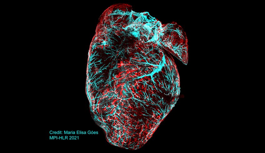 Straßen, die ein Herz umgeben: Das Bild zeigt das Gefäßsystem eines Mäuseherzens 24h nach Myokardinfarkt. Der Marker Alpha Smooth Muscle Actin färbt das Blutgefäßsystem (cyan) und Lyve-1 färbt die kardialen Lymphgefäße (rot). Das Bild wurde mit einem Light Sheet UltraMicroscope (La Vision) aufgenommen. Straßen, die ein Herz umgeben: Das Bild zeigt das Gefäßsystem eines Mäuseherzens 24h nach Myokardinfarkt. Der Marker Alpha Smooth Muscle Actin färbt das Blutgefäßsystem (cyan) und Lyve-1 färbt die kardialen Lymphgefäße (rot). Das Bild wurde mit einem Light Sheet UltraMicroscope (La Vision) aufgenommen.