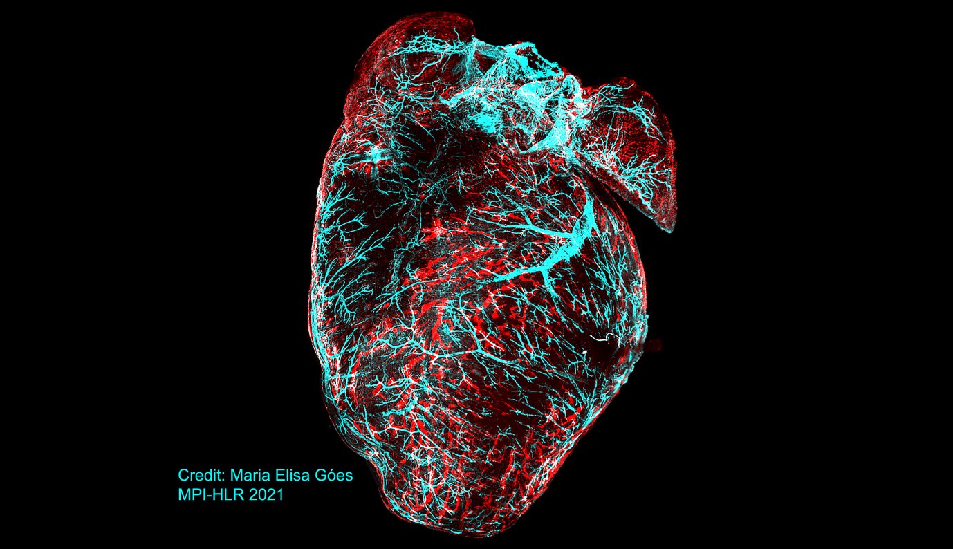 Roads that embrace a heart: The image shows the vasculature of a murine heart 24h after myocardial infarction. The marker alpha smooth muscle actin stains the blood vasculature (cyan) and Lyve-1 stains cardiac lymphatics (red). The image was acquired with a Light Sheet UltraMicroscope (La Vision).