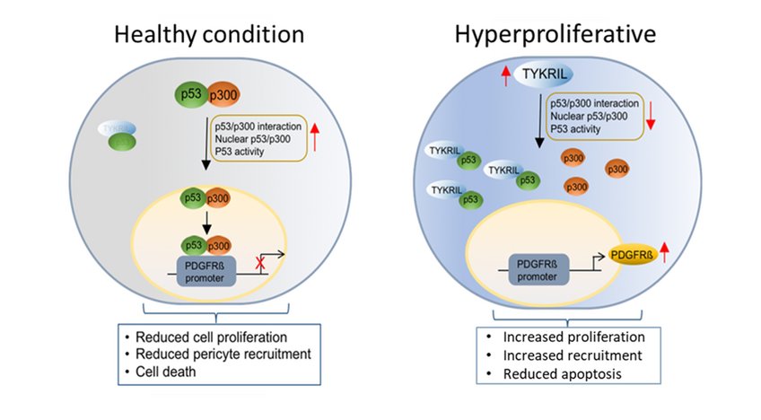 Diese Arbeit identifiziert die bislang uncharackterisierte, lange nichtkodierende RNA TYKRIL als wichtiges Signalmolekül für die Pathogenese der pulmonal arteriellen Hypertonie (PAH) durch Regulierung der p53/PDGFRβ-Signalachse. TYKRIL könnte ein relevantes Zielmolekül für zukünftige neue PAH Therapiestrategien darstellen. Diese Arbeit identifiziert die bislang uncharackterisierte, lange nichtkodierende RNA TYKRIL als wichtiges Signalmolekül für die Pathogenese der pulmonal arteriellen Hypertonie (PAH) durch Regulierung der p53/PDGFRβ-Signalachse. TYKRIL könnte ein relevantes Zielmolekül für zukünftige neue PAH Therapiestrategien darstellen.