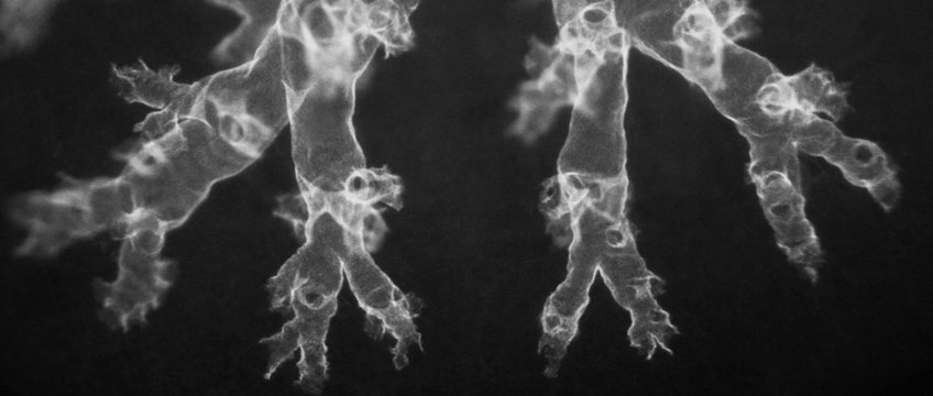 Cellular constituents of lung regeneration and tumorigenesis Cellular constituents of lung regeneration and tumorigenesis