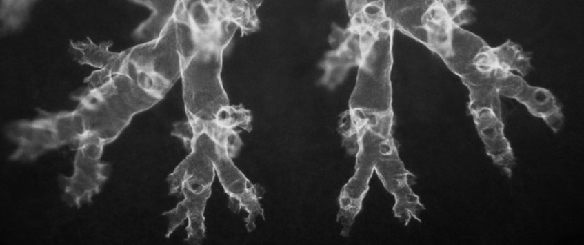 Cellular constituents of lung regeneration and tumorigenesis Cellular constituents of lung regeneration and tumorigenesis