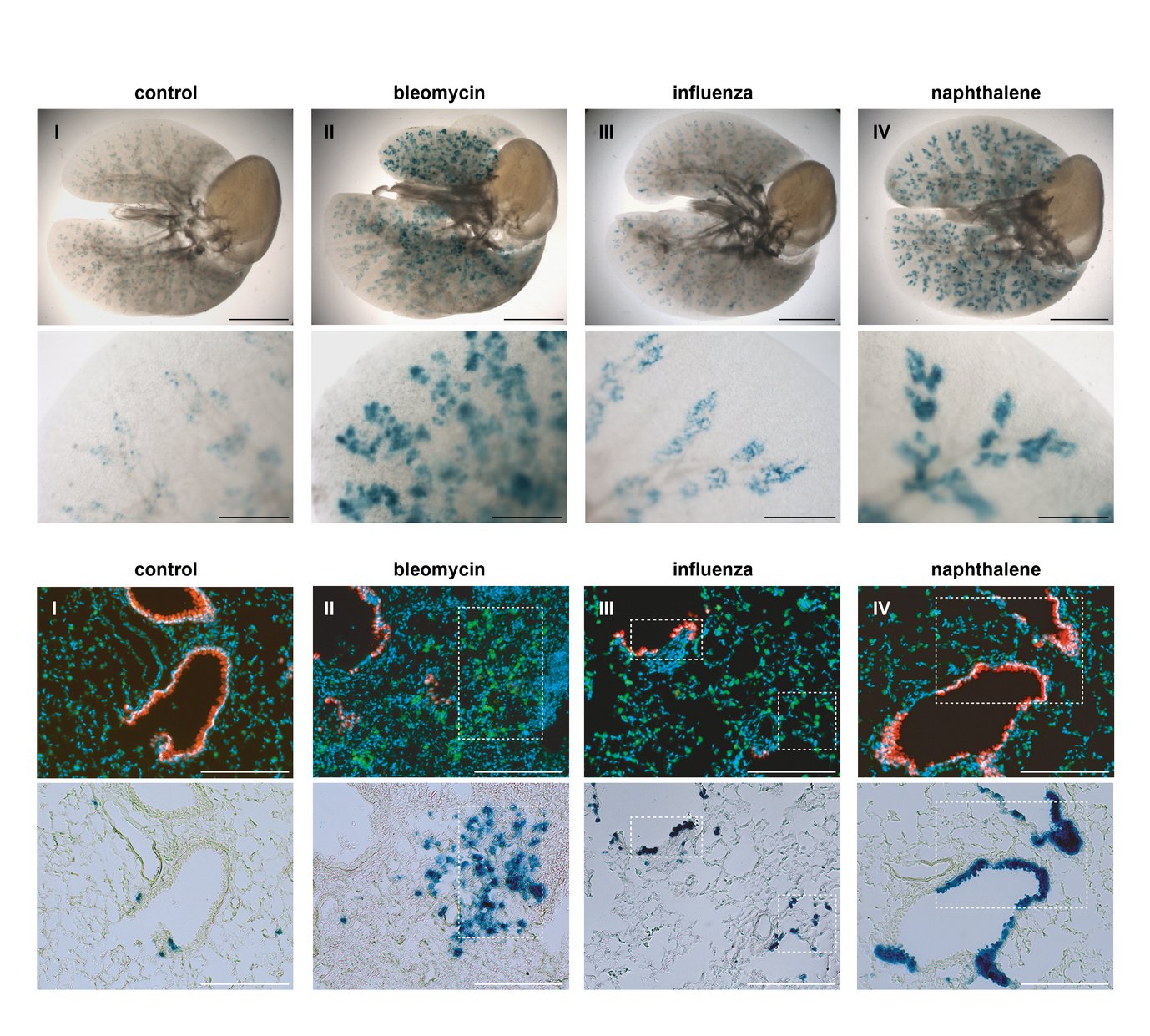BASCs contribute substantially to distal lung regeneration and display a bi-potent differentiation potential. Top: β‐galactosidase staining of cleared whole lung preparations isolated from control and injured BASC-specific animals (SPC-2A YFP-2A tTA N, CCSP-2A mCherry-2A tTA C, tetObiluc/Cre, Rosa26stopflox-lacZ) 21 days (bleomycin, naphthalene) or 35 days (influenza) following injury. Bottom: Sequential imaging of epifluorescence and β‐galactosidase activity, illustrating the alveolar and bronchiolar fate of BASC-derived cells.