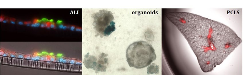 2D air-liquid interface cultures (ALI), complex 3D organoid models or precision-cut lung slices (PCLS) mimic to varying degrees the cellular and structural complexity of the lung. In vitro/ex vivo cultures are used to e.g. model the bronchiolar niche and study the characteristics of airway epithelial cells, to test the capacity of different mesenchymal stem cell subsets in promoting the growth, maintenance and differentiation of epithelial progenitor cells or to screen the properties of potential therapeutic molecules. 2D air-liquid interface cultures (ALI), complex 3D organoid models or precision-cut lung slices (PCLS) mimic to varying degrees the cellular and structural complexity of the lung. In vitro/ex vivo cultures are used to e.g. model the bronchiolar niche and study the characteristics of airway epithelial cells, to test the capacity of different mesenchymal stem cell subsets in promoting the growth, maintenance and differentiation of epithelial progenitor cells or to screen the properties of potential therapeutic molecules.