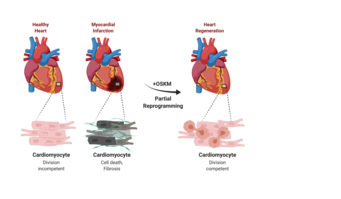 The healthy heart contains an association of cardiac muscle cells that are hardly capable of division. Only sporadically are heart muscle cells slowly replaced during a person's lifetime. Myocardial infarction: Due to the occlusion of coronary arteries, cardiac muscle cells are no longer supplied with sufficient oxygen and nutrients, which leads to their death. A connective tissue ("fibrotic") scar forms to close the resulting gap in the cell structure. Cardiac regeneration: Short-term, controlled expression of regulatory factors (OSKM: = Oct4, Sox2, Klf4, c-Myc) leads to partial reprogramming of cardiac myocytes. Cardiac muscle cells rewind their developmental program and thereby temporarily regain their ability to divide. The dividing cardiac muscle cells refill the gap created by the myocardial infarction, the heart regenerates and scarring is avoided (The figure was created with the help of biorender). The healthy heart contains an association of cardiac muscle cells that are hardly capable of division. Only sporadically are heart muscle cells slowly replaced during a person's lifetime. Myocardial infarction: Due to the occlusion of coronary arteries, cardiac muscle cells are no longer supplied with sufficient oxygen and nutrients, which leads to their death. A connective tissue ("fibrotic") scar forms to close the resulting gap in the cell structure. Cardiac regeneration: Short-term, controlled expression of regulatory factors (OSKM: = Oct4, Sox2, Klf4, c-Myc) leads to partial reprogramming of cardiac myocytes. Cardiac muscle cells rewind their developmental program and thereby temporarily regain their ability to divide. The dividing cardiac muscle cells refill the gap created by the myocardial infarction, the heart regenerates and scarring is avoided (The figure was created with the help of biorender).