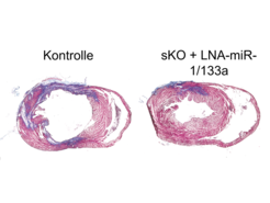 Gewebeschnitte von Herzen nach einem Myokardinfarkt. Im Vergleich zur Kontrolle führt das Ausschalten von miR-1/133a im Tiermodell zu einem kleineren Infarktareal (blau eingefärbt)
