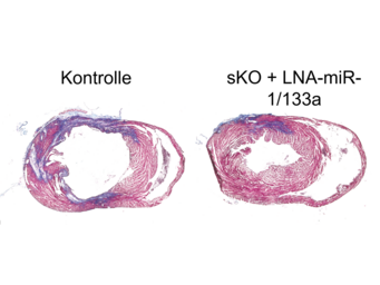 Gewebeschnitte von Herzen nach einem Myokardinfarkt. Im Vergleich zur Kontrolle führt das Ausschalten von miR-1/133a im Tiermodell zu einem kleineren Infarktareal (blau eingefärbt) Gewebeschnitte von Herzen nach einem Myokardinfarkt. Im Vergleich zur Kontrolle führt das Ausschalten von miR-1/133a im Tiermodell zu einem kleineren Infarktareal (blau eingefärbt)