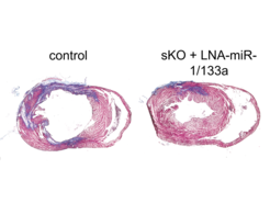 Tissue sections of hearts after myocardial infarction. Compared to the control, silencing miR-1/133a in the animal model leads to a smaller infarct area (coloured blue).