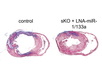 Tissue sections of hearts after myocardial infarction. Compared to the control, silencing miR-1/133a in the animal model leads to a smaller infarct area (coloured blue). Tissue sections of hearts after myocardial infarction. Compared to the control, silencing miR-1/133a in the animal model leads to a smaller infarct area (coloured blue).