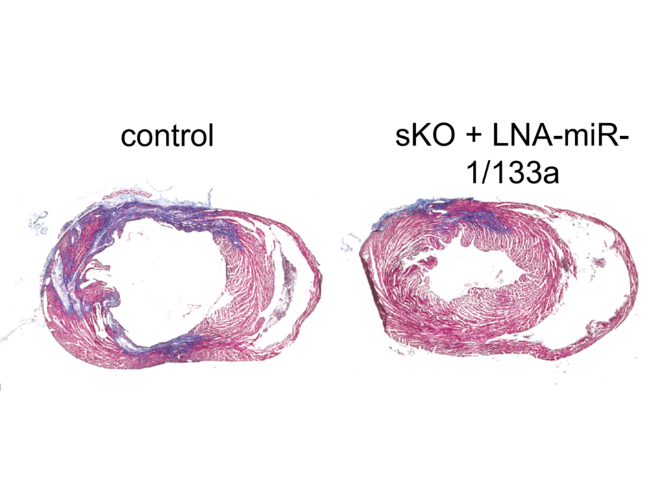 Tissue sections of hearts after myocardial infarction. Compared to the control, silencing miR-1/133a in the animal model leads to a smaller infarct area (coloured blue).