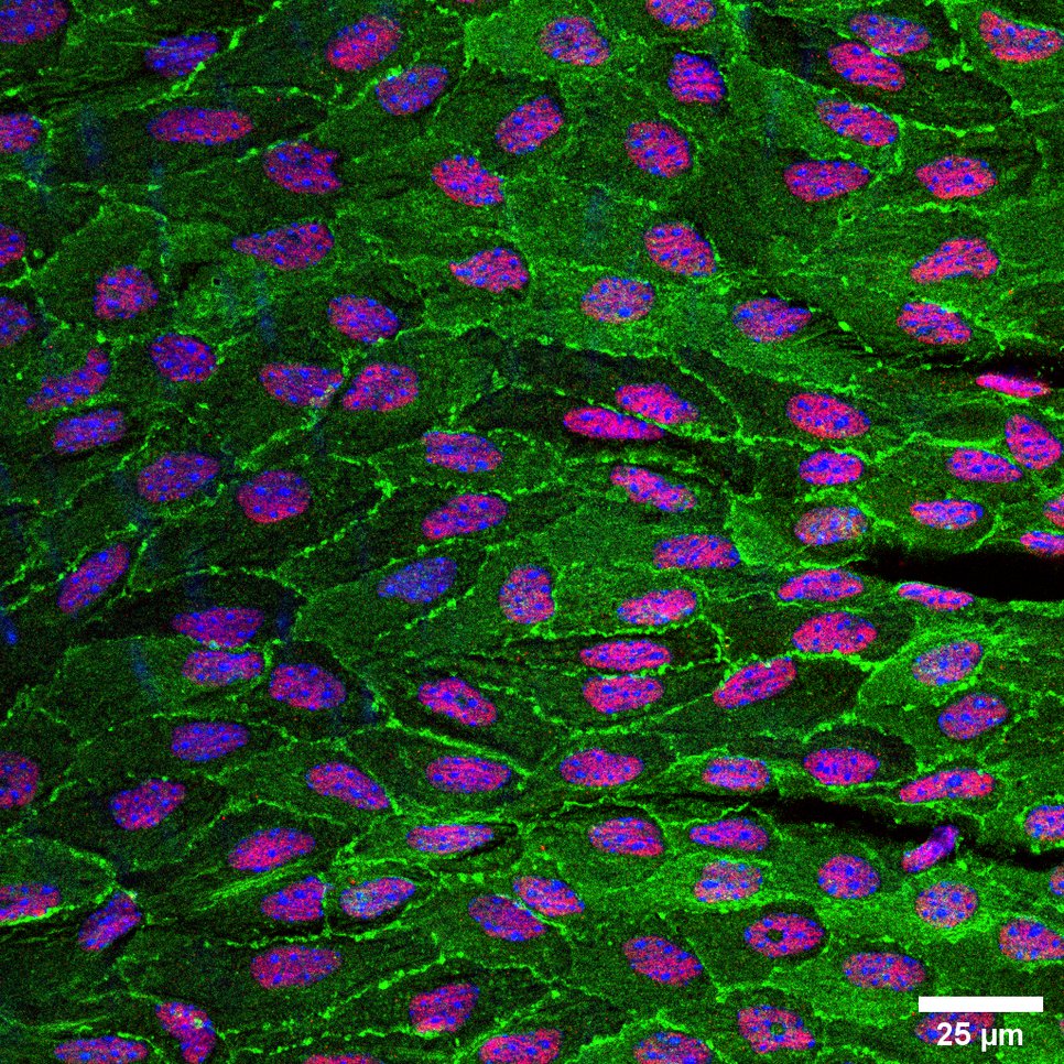 Confocal imaging of a mouse descending aorta (adult c57bl6J mouse). Blue: nuclei, Green: membrane of endothelial cells, Red: transcription factor expressed by endothelial cells. The picture represents a maximum intensity projection of several optical plane images.