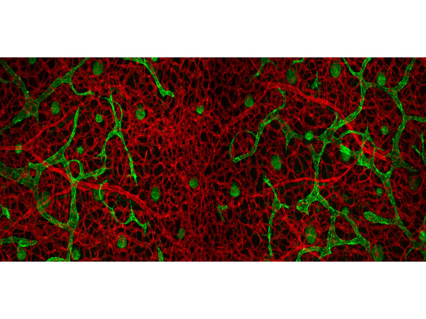 Nicht alle Gefäße sind gleich. Die Fluoreszenzaufnahme zeigt Blutgefäße (rot) und Lymphgefäße (grün). Während der Entwicklung entspringen diese aus unterschiedlichen Arealen des Embryos.