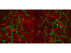 Nicht alle Gefäße sind gleich. Die Fluoreszenzaufnahme zeigt Blutgefäße (rot) und Lymphgefäße (grün). Während der Entwicklung entspringen diese aus unterschiedlichen Arealen des Embryos.