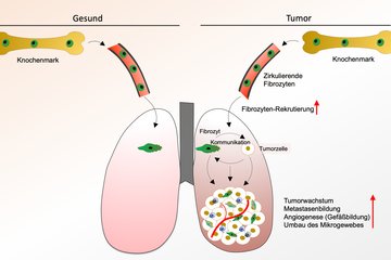 Schematische Darstellung der Interaktion zwischen Fibrozyten und Tumorzellen innerhalb des Mikroumgebung des Tumors. Bild: MPI für Herz- und Lungenforschung.