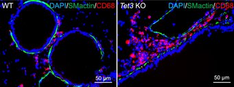 Mikroskopische Darstellung der Infiltration der Lunge mit Immunzellen bei Mäusen ohne das TET3-Enzym. Im Vergleich zur Lunge von Kontrolltieren (links) sammeln sich in der Lunge von Mäusen ohne TET3 Immunzellen (Makrophagen, rot gefärbt) an. Zellkerne sind blau, glatte Muskelzellen grün gefärbt. Mikroskopische Darstellung der Infiltration der Lunge mit Immunzellen bei Mäusen ohne das TET3-Enzym. Im Vergleich zur Lunge von Kontrolltieren (links) sammeln sich in der Lunge von Mäusen ohne TET3 Immunzellen (Makrophagen, rot gefärbt) an. Zellkerne sind blau, glatte Muskelzellen grün gefärbt.