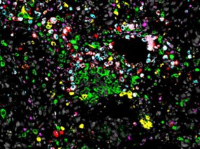 Lung Development and Remodelling (Dept. IV)