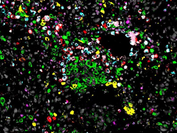 Lung Development and Remodelling (Emeritus Group)