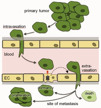 The metastatic cascade. EC, endothelial cell The metastatic cascade. EC, endothelial cell