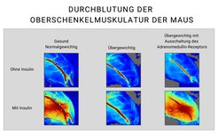 In gesunden, normalgewichtigen Mäusen führt Insulin durch Aktivierung seines Rezeptors auf der Innenseite der Blutgefäße (dem Endothel) zu einer erhöhten Durchblutung der Muskulatur (rote Färbung, Abbildungen links). Dadurch erreichen Insulin sowie Traubenzucker (Glukose) effizient die Zellen der Muskulatur, und Insulin fördert dort die Aufnahme von Glukose in die Muskelzellen. Dies hat eine Abnahme des Blutzuckerspiegels zur Folge. In übergewichtigen diabetischen Mäusen (mittlere Abbildungen) besteht eine erhebliche Insulinresistenz im Gefäßsystem, wodurch Insulin kaum noch einen Effekt auf die Durchblutung der Muskulatur besitzt. Diese Insulinresistenz im Gefäßsystem wird durch erhöhte Adrenomedullin Spiegel hervorgerufen. Wird der Adrenomedullin-Rezeptor in übergewichtigen, diabetischen Tieren ausgeschaltet (Abbildungen rechts), verliert Adrenomedullin seine Wirkung, und die Insulinresistenz nimmt deutlich ab. Insulin kann nun - wie im gesunden Zustand - eine deutlich erhöhte Muskeldurchblutung hervorrufen, was zu einer verbesserten Stoffwechsellage mit verringerten Blutzuckerwerten führt. Fotos: MPI für Herz- und Lungenforschung.