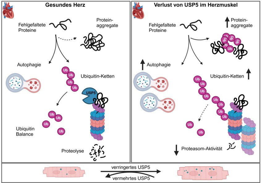 Schematische Darstellung der Wirkweise von USP5 im Herzen. Im gesunden Herzen organisiert USP5 das Recycling defekter Proteine. Ist die USP5-Konzentration zu niedrig, funktioniert das Recycling nicht mehr. Dies führt zu geschädigten Herzmuskelzellen und dadurch zu einer dilatativen Kardiomyopathie. Schematische Darstellung der Wirkweise von USP5 im Herzen. Im gesunden Herzen organisiert USP5 das Recycling defekter Proteine. Ist die USP5-Konzentration zu niedrig, funktioniert das Recycling nicht mehr. Dies führt zu geschädigten Herzmuskelzellen und dadurch zu einer dilatativen Kardiomyopathie.