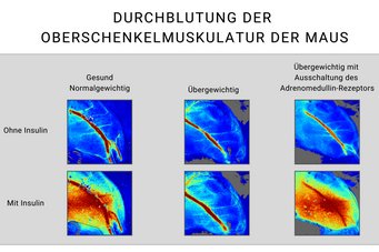 In gesunden, normalgewichtigen Mäusen führt Insulin durch Aktivierung seines Rezeptors auf der Innenseite der Blutgefäße (dem Endothel) zu einer erhöhten Durchblutung der Muskulatur (rote Färbung, Abbildungen links). Dadurch erreichen Insulin sowie Traubenzucker (Glukose) effizient die Zellen der Muskulatur, und Insulin fördert dort die Aufnahme von Glukose in die Muskelzellen. Dies hat eine Abnahme des Blutzuckerspiegels zur Folge. In übergewichtigen diabetischen Mäusen (mittlere Abbildungen) besteht eine erhebliche Insulinresistenz im Gefäßsystem, wodurch Insulin kaum noch einen Effekt auf die Durchblutung der Muskulatur besitzt. Diese Insulinresistenz im Gefäßsystem wird durch erhöhte Adrenomedullin Spiegel hervorgerufen. Wird der Adrenomedullin-Rezeptor in übergewichtigen, diabetischen Tieren ausgeschaltet (Abbildungen rechts), verliert Adrenomedullin seine Wirkung, und die Insulinresistenz nimmt deutlich ab. Insulin kann nun - wie im gesunden Zustand - eine deutlich erhöhte Muskeldurchblutung hervorrufen, was zu einer verbesserten Stoffwechsellage mit verringerten Blutzuckerwerten führt. Fotos: MPI für Herz- und Lungenforschung. Vergleich der Durchblutung der Oberschenkelmuskulatur von Mäusen: gesund, übergewichtig und mit ausgeschaltetem Adrenomedullin-Rezeptor.