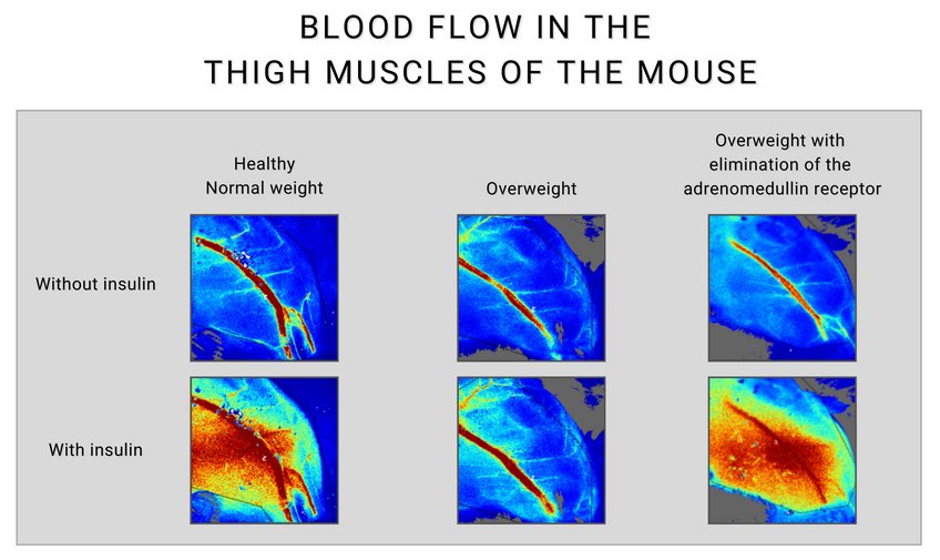 In healthy, normal-weight mice, insulin increases blood flow to the muscles by activating its receptor on the inside of the blood vessels (the endothelium) (shown in red, left). As a result, insulin and glucose reach the muscle cells efficiently, and insulin promotes the uptake of glucose into the muscle cells. This leads to a reduction in blood glucose levels. In overweight diabetic mice (middle pictures), there is considerable insulin resistance in the vascular system, which means that insulin has little effect on blood flow to the muscles. This insulin resistance in the vasculature is caused by increased levels of adrenomedullin. If the adrenomedullin receptor is switched off in overweight diabetic animals (right), adrenomedullin loses its effect and insulin resistance decreases significantly. Insulin can now, as in a healthy state, cause a significant increase in muscle perfusion, leading to an improved metabolic state with reduced blood glucose levels. Comparison of blood flow in mouse thigh muscles, with and without insulin, across different health conditions.