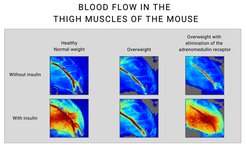 Comparison of blood flow in mouse thigh muscles, with and without insulin, across different health conditions.