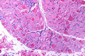 Microscopic image of muscle tissue featuring pink-stained muscle fibers intertwined with blue-stained connective tissue, highlighting cellular detail.