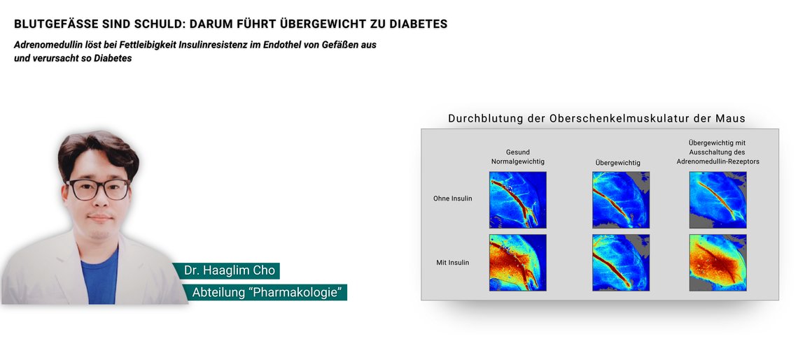 Vergleich der Durchblutung der Oberschenkelmuskulatur von Mäusen: gesund, übergewichtig und mit ausgeschaltetem Adrenomedullin-Rezeptor.