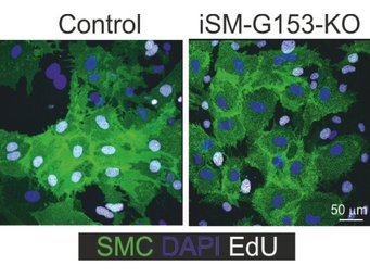 Smooth muscle cells under a fluorescence microscope: If smooth muscle cells lack the GPR153 receptor (right), they divide significantly less than when GPR 153 is present. This can be seen in the white-coloured cell nuclei. The smooth muscle cells are coloured green. Cell nuclei that have not divided are shown in blue. Smooth muscle cells under a fluorescence microscope