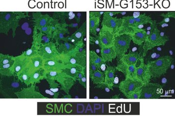 Smooth muscle cells under a fluorescence microscope