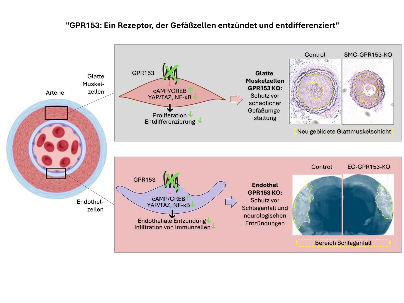 "GPR153: Ein Rezeptor, der Gefäßzellen entzündet und entdifferenziert"