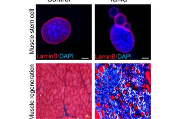 Full muscle power only with TAF4A: If the transcription factor is active in muscle stem cells, the cell nuclei are intact (top left), while the absence of TAF4A results in unstable cell nuclei (top right). As a result, the regenerative capacity of muscles (bottom row) without TAF4A (right) is severely impaired. In comparison, the muscle cells in the tissue section of control animals with TAF4A appear regular and intact.
