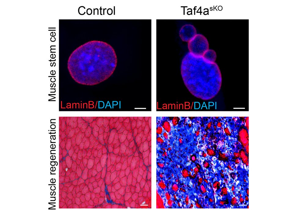 Full muscle power only with TAF4A: If the transcription factor is active in muscle stem cells, the cell nuclei are intact (top left), while the absence of TAF4A results in unstable cell nuclei (top right). As a result, the regenerative capacity of muscles (bottom row) without TAF4A (right) is severely impaired. In comparison, the muscle cells in the tissue section of control animals with TAF4A appear regular and intact.