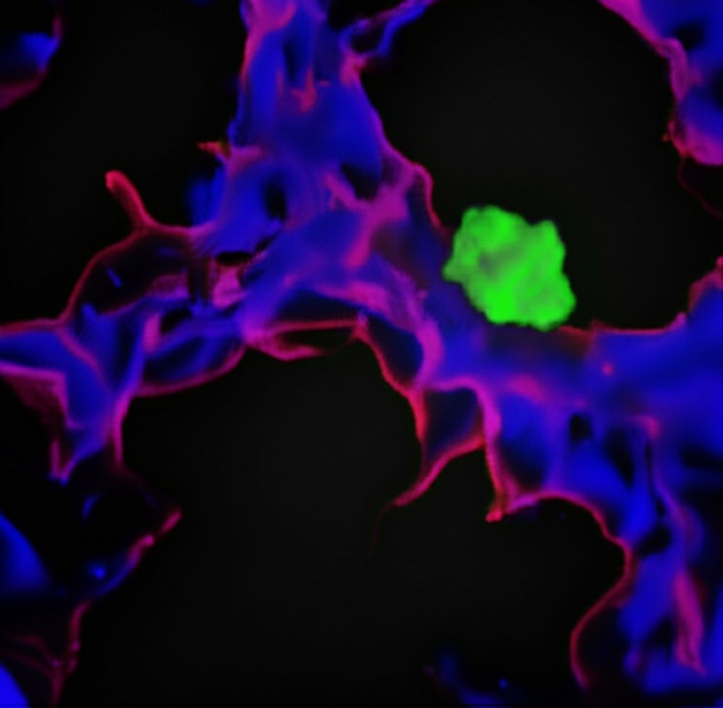 Laser confocal microscope image of a ‘sleeping’ tumour cell (green) in the vicinity of a blood vessel (red/blue).