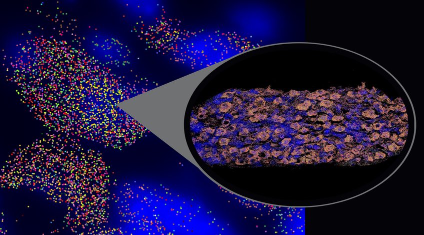 Spatial Transcriptomics der sympathischen Ganglien einer Maus, dargestellt in unterschiedlichen Zoomstufen. Mit der Vizgen/MERSCOPE-Technologie wurden 180 verschiedene Gene gleichzeitig nachgewiesen – jedes in einer eigenen Farbe. Die blauen Bereiche markieren die Zellkerne, sodass man die Positionen der Zellen und die Aktivität der Gene räumlich nachvollziehen kann. Spatial Transcriptomics der sympathischen Ganglien einer Maus, dargestellt in unterschiedlichen Zoomstufen.