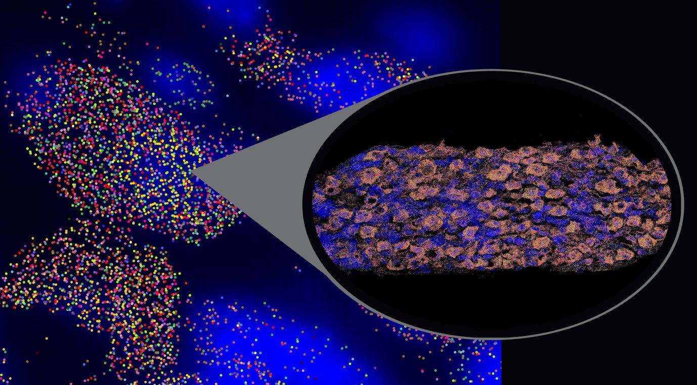 Spatial transcriptomics of the sympathetic ganglia of a mouse, shown at different zoom levels