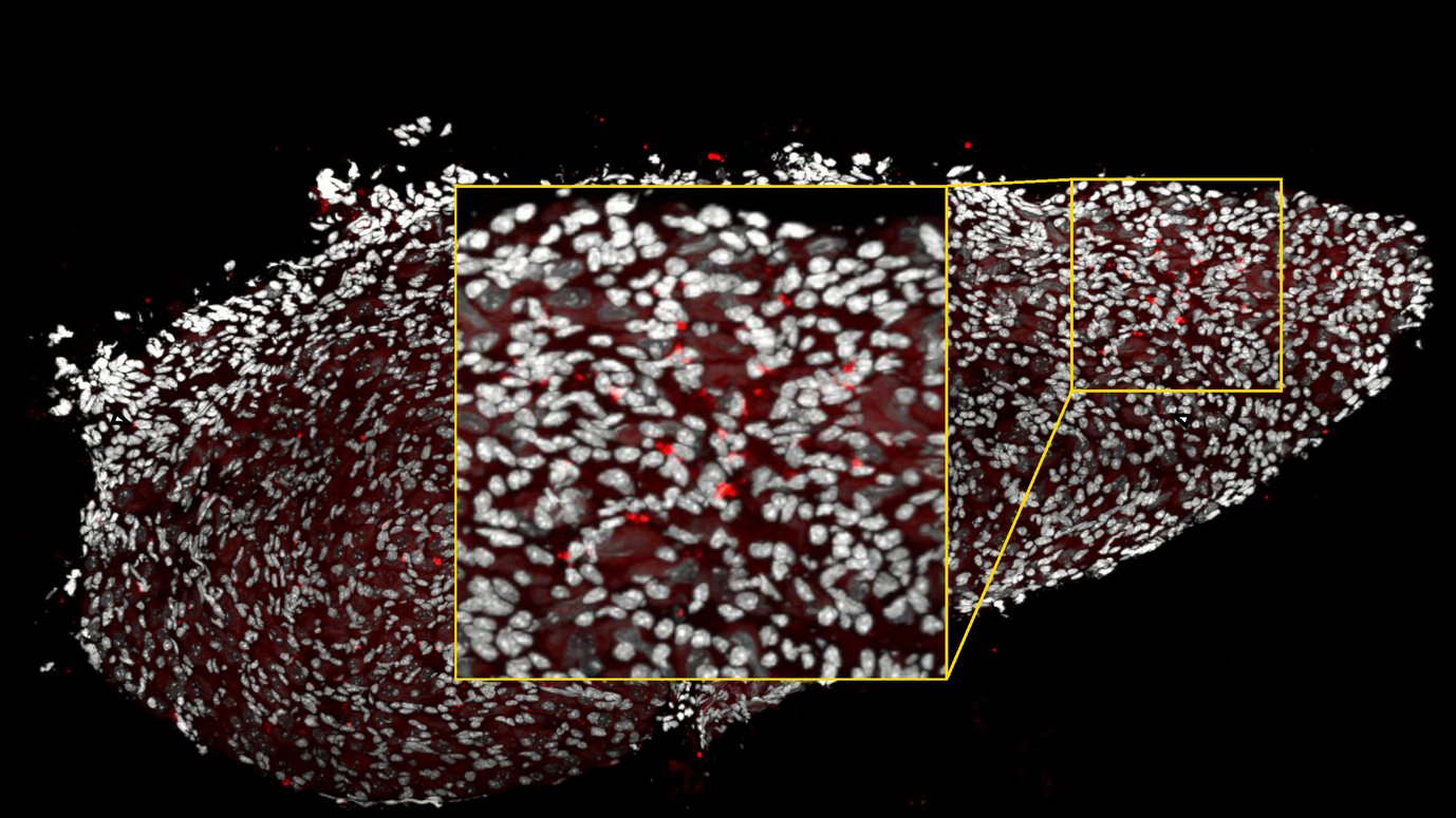 Immunofluorescence image of a ganglion in a mouse with heart disease