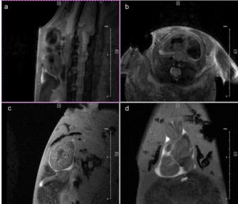Fig. 3: Newt heart MRI. In the upper panel two localizer scans (RARE method (rapid acquisition with relaxation enhancement) with a repetition time of 2500 ms, echo time of 36.7 ms, slice thickness/interslice distance: 0.50/0.50 mm, field of view 2.50x2.50 cm2 and a matrix of 256/256 (a)) are shown: two 2-chamber views (a,b). In the lower panel an image of the ventricle in axial (c) and coronal (d) orientation is presented. We imaged the animal with an Intragate Flash (Fast Low Angle Shot) sequence: repetition time: 5.6 ms; echo time: 2.9 ms; oversampling: 150 (c) or 300 (d); flip angle: 10 deg; slice thickness/interslice distance: 0.3/0.3 mm; FOV: 15x15 mm and  matrix: 256/256 (c) or 128/128 (d) using the 72 mm volume transmit-only room temperature and the cryogenic 4 element 1H array receive-only coil. Fig. 3: Newt heart MRI. In the upper panel two localizer scans (RARE method (rapid acquisition with relaxation enhancement) with a repetition time of 2500 ms, echo time of 36.7 ms, slice thickness/interslice distance: 0.50/0.50 mm, field of view 2.50x2.50 cm2 and a matrix of 256/256 (a)) are shown: two 2-chamber views (a,b). In the lower panel an image of the ventricle in axial (c) and coronal (d) orientation is presented. We imaged the animal with an Intragate Flash (Fast Low Angle Shot) sequence: repetition time: 5.6 ms; echo time: 2.9 ms; oversampling: 150 (c) or 300 (d); flip angle: 10 deg; slice thickness/interslice distance: 0.3/0.3 mm; FOV: 15x15 mm and  matrix: 256/256 (c) or 128/128 (d) using the 72 mm volume transmit-only room temperature and the cryogenic 4 element 1H array receive-only coil.