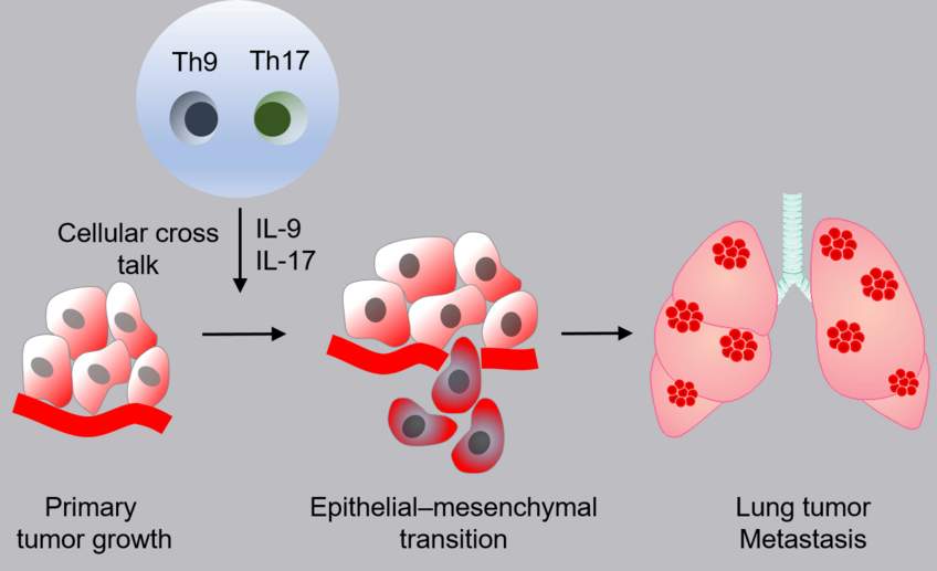 Immune cells support the development of lung metastases: The schematic diagram shows how T cells (Th9 / Th17) change lung tumor cells by releasing messenger substances. Tumor cells thereby convert into metastases. Immune cells support the development of lung metastases: The schematic diagram shows how T cells (Th9 / Th17) change lung tumor cells by releasing messenger substances. Tumor cells thereby convert into metastases.